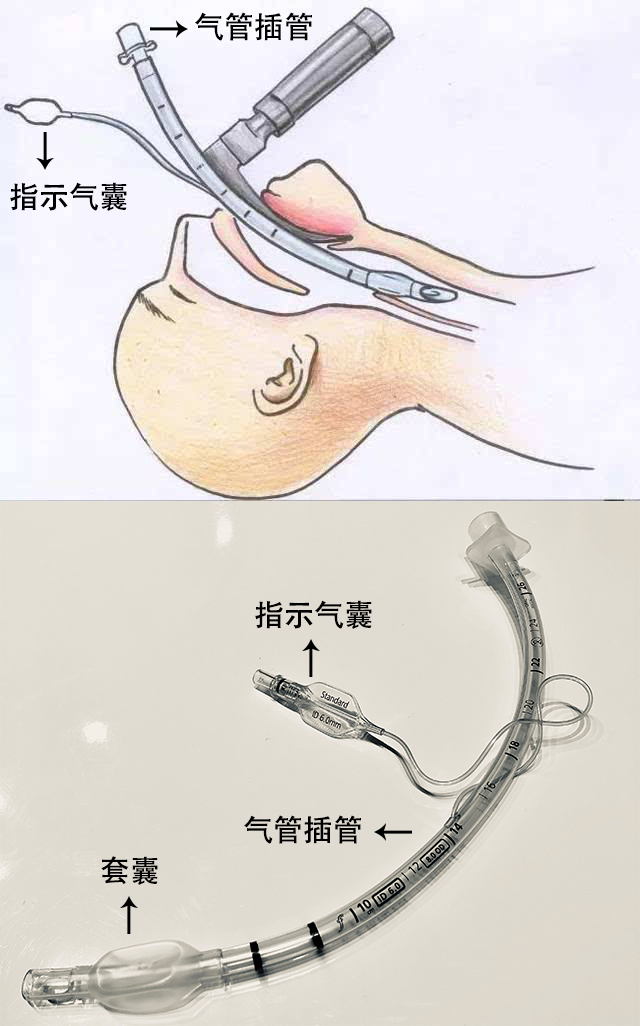 贊！！！250萬指示氣囊，客戶100%滿意！